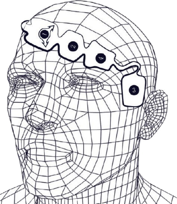 Patient Monitoring with Bispectral Index EEG Sensors