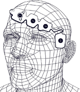 Patient Monitoring with Bispectral Index EEG Sensors