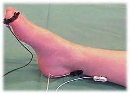 TOF 3D Thumb Adapters